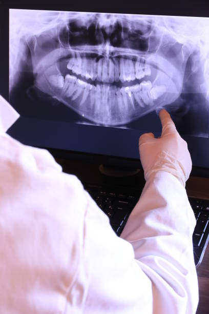 Best Emergency Dental Care for Sports Injuries in Crestwood, KY