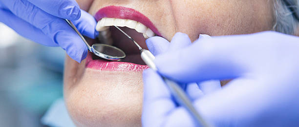Best Knocked-Out Tooth (Avulsed Tooth) Treatment in Crestwood, KY